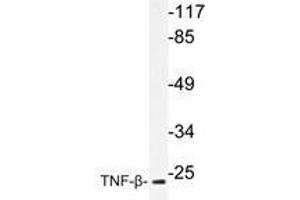Western blot analysis of TNF-β antibody in extracts from COS-7cells. (LTA anticorps)