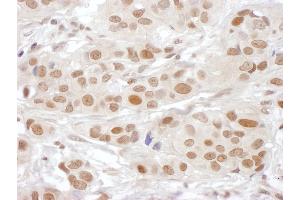 anti-GINS Complex Subunit 3 (Psf3 Homolog) (GINS3) (AA 166-216) antibody