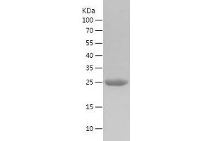 Western Blotting (WB) image for Fucosidase, alpha-L- 1, Tissue (FUCA1) (AA 269-466) protein (His tag) (ABIN7123011)