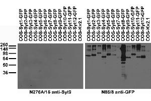 Immunohistochemistry with antigen retrieval via citrate pretreatment. (LGI1 anticorps  (AA 37-113))
