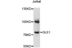 Western blot analysis of extracts of Jurkat cells, using GLE1 antibody (ABIN6293109) at 1:3000 dilution. (GLE1 anticorps)