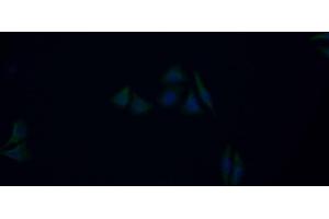 Detection of MMP9 in Human HepG2 cell using Polyclonal Antibody to Matrix Metalloproteinase 9 (MMP9)