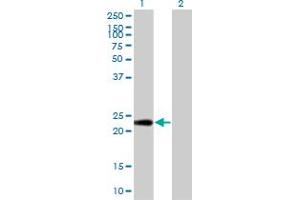 Western Blot analysis of PTTG1IP expression in transfected 293T cell line by PTTG1IP monoclonal antibody (M04), clone 4C11. (PTTG1IP anticorps  (AA 1-180))