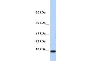 WB Suggested Anti-PCBD1 Antibody Titration:  0. (PCBD1 anticorps  (N-Term))