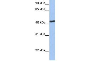 TMEM149 antibody used at 1 ug/ml to detect target protein. (IGF-like family receptor 1 (IGFLR1) (N-Term) anticorps)