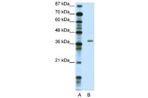 WB Suggested Anti-ZNF444  Antibody Titration: 2. (ZNF444 anticorps  (C-Term))