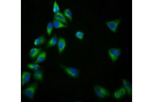 Immunofluorescence staining of Hela cells with ABIN7153359 at 1:166, counter-stained with DAPI. (Gpr98 anticorps  (AA 6155-6306))