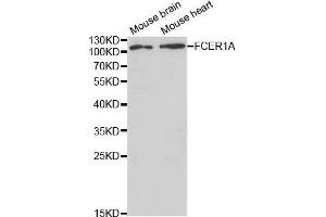 Western blot analysis of extracts of various cell lines, using FCER1A antibody. (Fc epsilon RI/FCER1A anticorps  (AA 26-205))
