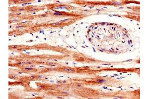 IHC image of ABIN7168677 diluted at 1:600 and staining in paraffin-embedded human heart tissue performed on a Leica BondTM system. (SFRP1 anticorps  (AA 170-240))