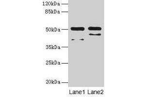 Western blot All lanes: CRHR1 antibody at 16 μg/mL Lane 1: Hela whole cell lysate Lane 2: HL60 whole cell lysate Secondary Goat polyclonal to rabbit IgG at 1/10000 dilution Predicted band size: 51, 48, 44, 47, 29 kDa Observed band size: 51 kDa (CRHR1 anticorps  (AA 24-121))