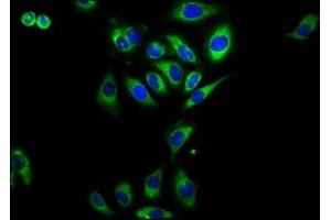 Immunofluorescence staining of A549 cells with ABIN7167433 at 1:230, counter-stained with DAPI. (RAMP2 anticorps  (AA 43-145))