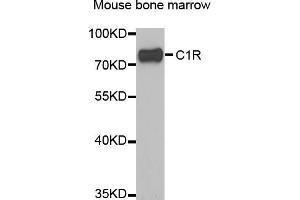 Western blot analysis of extracts of mouse bone marrow, using C1R antibody (ABIN5973769) at 1/1000 dilution. (C1R anticorps)
