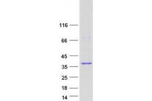 Validation with Western Blot