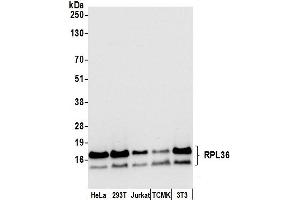 anti-Ribosomal Protein L36 (RPL36) (AA 1-50) antibody