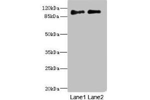Western blot All lanes: ICAM5 antibody at 4. (ICAM5 anticorps  (AA 32-180))