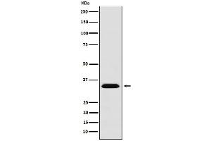 Western blot analysis of MBD3 expression in 293T cell lysate.