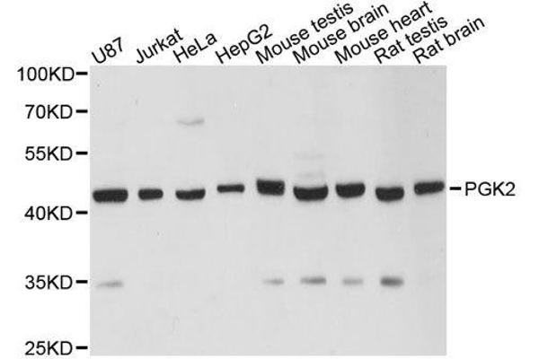 PGK2 anticorps  (AA 242-360)