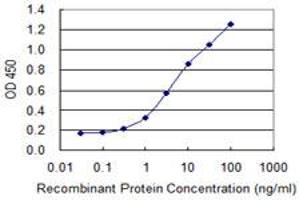 anti-SERTA Domain Containing 1 (SERTAD1) (AA 1-236) antibody