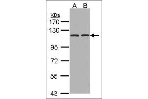 Sample(30 µg whole cell lysate).