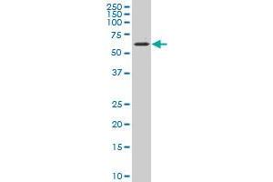 CYP7B1 polyclonal antibody (A01), Lot # 060516JCS1 Western Blot analysis of CYP7B1 expression in NIH/3T3 .