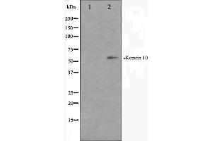 Western blot analysis on HeLa cell lysate using Keratin 10 Antibody. (Keratin 10 anticorps  (Internal Region))