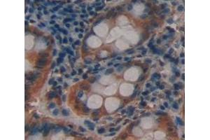 Used in DAB staining on fromalin fixed paraffin- embedded Kidney tissue (ACTN3 anticorps  (AA 162-416))
