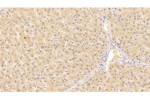 Detection of ALT in Human Liver Tissue using Monoclonal Antibody to Alanine Aminotransferase (ALT) (ALT anticorps  (AA 255-492))