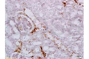 Formalin-fixed and paraffin embedded mouse kidney labeled with Anti AAK1 Polyclonal Antibody, Unconjugated (ABIN687517) at 1:200 followed by conjugation to the secondary antibody and DAB staining