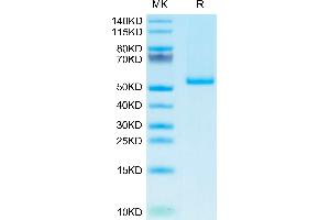 Human 4-1BB Ligand Trimer on Tris-Bis PAGE under reduced condition.
