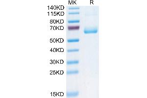 Human CD161 on Tris-Bis PAGE under reduced condition. (CD161 Protein (AA 67-225) (Fc Tag))