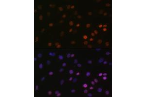 Immunofluorescence analysis of C6 cells using MonoMethyl-Histone H2B-K5 antibody (ABIN7267735) at dilution of 1:100. (Histone H2B anticorps  (meLys5))