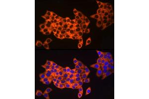 Immunofluorescence analysis of HeLa cells using UB Rabbit mAb (ABIN7271128) at dilution of 1:50 (40x lens). (UBA52 anticorps)