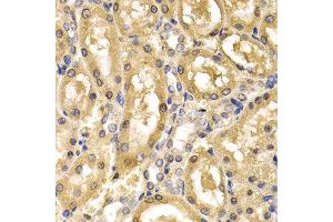Immunohistochemistry of paraffin-embedded rat kidney using ADH4 antibody at dilution of 1:200 (400x lens). (ADH4 anticorps)