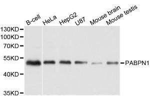 Western blot analysis of extracts of various cell lines, using PABPN1 antibody. (PABPN1 anticorps  (AA 1-100))