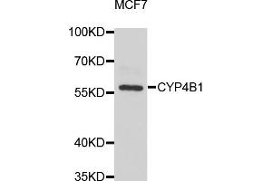 Western blot analysis of extracts of MCF-7 cells, using CYP4B1 antibody (ABIN5975064) at 1/1000 dilution. (CYP4B1 anticorps)