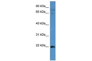 MAP3K15 antibody used at 1 ug/ml to detect target protein.