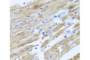 Immunohistochemistry of paraffin-embedded Rat heart using MOK Polyclonal Antibody at dilution of 1:100 (40x lens).