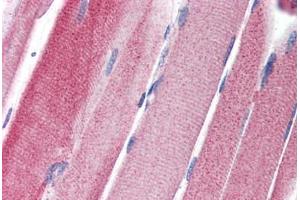 Human Skeletal Muscle (formalin-fixed, paraffin-embedded) stained with GPAM antibody ABIN351457 at 5 ug/ml followed by biotinylated goat anti-rabbit IgG secondary antibody ABIN481713, alkaline phosphatase-streptavidin and chromogen. (GPAM anticorps  (C-Term))