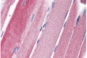 Human Skeletal Muscle (formalin-fixed, paraffin-embedded) stained with GPAM antibody ABIN351457 at 5 ug/ml followed by biotinylated goat anti-rabbit IgG secondary antibody ABIN481713, alkaline phosphatase-streptavidin and chromogen.