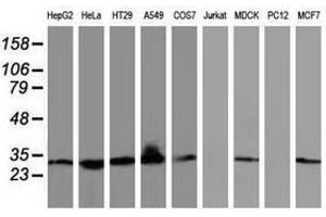 Image no. 3 for anti-Bridging Integrator 3 (BIN3) antibody (ABIN1496923)