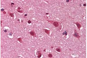 Human Brain, Cortex (formalin-fixed, paraffin-embedded) stained with DNM1 antibody ABIN291352 at 10 ug/ml followed by biotinylated goat anti-rabbit IgG secondary antibody ABIN481713, alkaline phosphatase-streptavidin and chromogen. (Dynamin 1 anticorps  (C-Term))