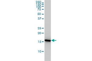 PPIA monoclonal antibody (M01), clone 1F4-1B5 Western Blot analysis of PPIA expression in Jurkat .