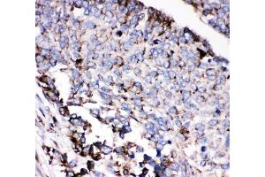 IHC analysis of AEBP2 using anti-AEBP2 antibody (ABIN4886435). (AEBP2 anticorps  (AA 424-517))