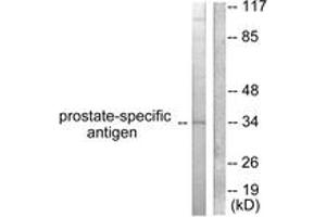 Western blot analysis of extracts from mouse heart cells, using Prostate-specific Antigen Antibody. (Prostate Specific Antigen anticorps  (AA 81-130))