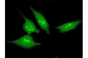 Immunofluorescence of monoclonal antibody to SCAND2 on HeLa cell. (SCAND2 anticorps  (AA 1-62))