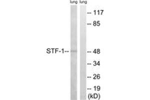 Image no. 1 for anti-Nuclear Receptor Subfamily 5, Group A, Member 1 (NR5A1) (AA 169-218) antibody (ABIN2889160) (NR5A1 anticorps  (AA 169-218))
