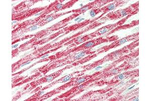 Human, Heart: Formalin-Fixed Paraffin-Embedded (FFPE).