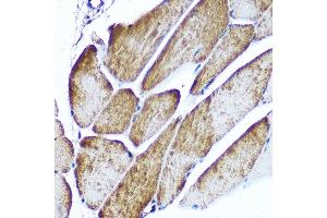 Immunohistochemistry of paraffin-embedded mouse brain using PLP1 Rabbit pAb (ABIN7269724) at dilution of 1:100 (40x lens).