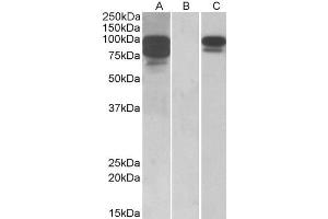HEK293 lysate (10ug protein in RIPA buffer) overexpressing Human PCSK9 with C-terminal MYC tag probed with ABIN570954 (1ug/ml) in Lane A and probed with anti-MYC Tag (1/1000) in lane C.