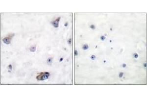 Immunohistochemistry analysis of paraffin-embedded human brain, using GABA-RB (Phospho-Ser434) Antibody. (GABA-RB (AA 401-450), (pSer434) anticorps)